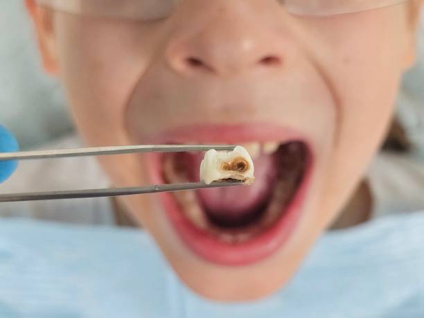 Best Emergency Root Canal Treatment in Girard, KS